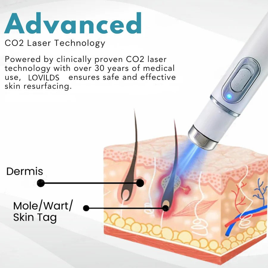 đĽăOFFICIAL STOREăLOVILDS⢠Non-Invasive Mole and Wart Removal Laser Pen