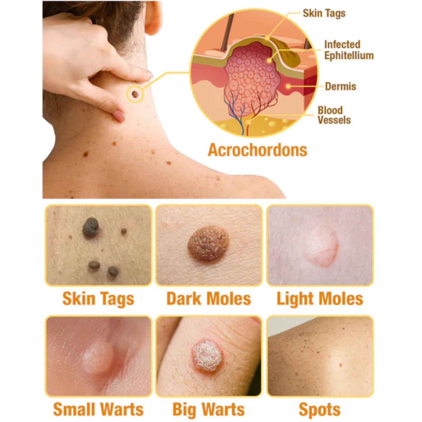 🐝Limited-Time Offer: 83% OFF🐝 LOVILDS™ TagRecede Bee Extract Treatment Spray💎