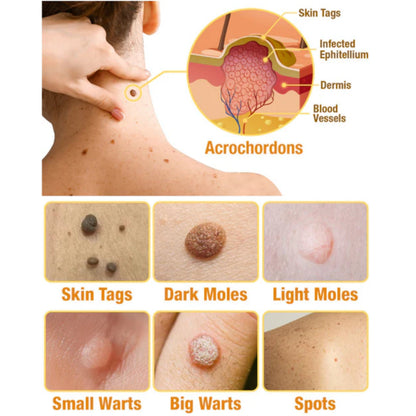 🐝Limited-Time Offer: 83% OFF🐝 LOVILDS™ TagRecede Bee Extract Treatment Spray💎