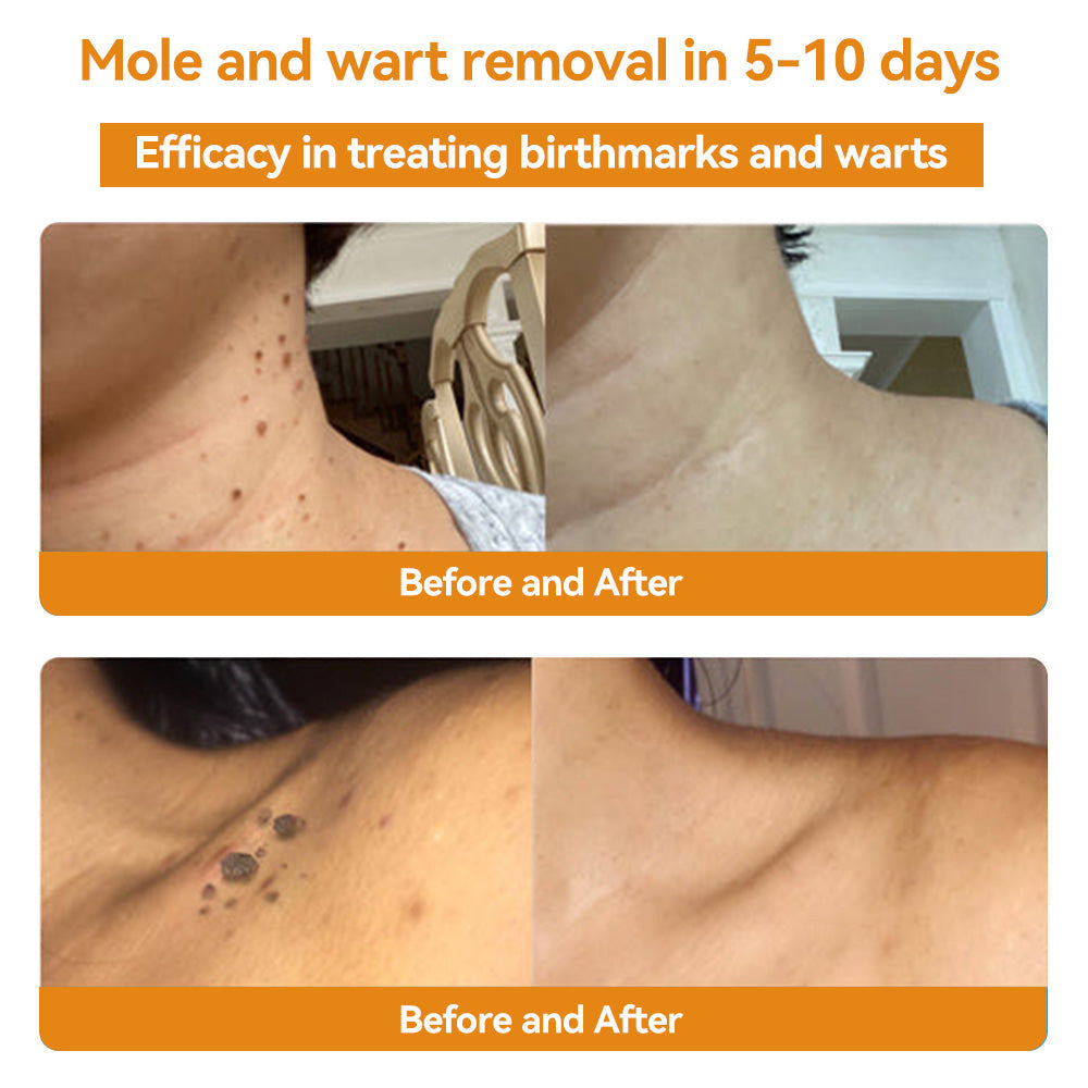 🐝Limited-Time Offer: 83% OFF🐝 LOVILDS™ TagRecede Bee Extract Treatment Spray💎