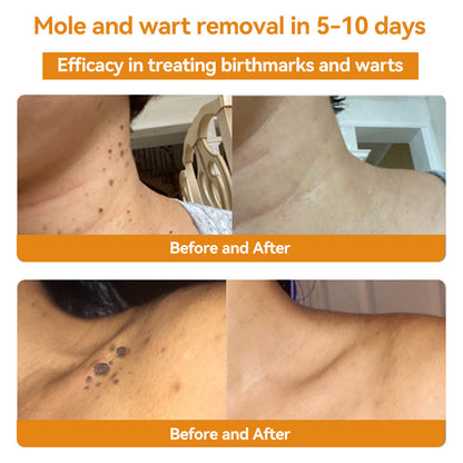 🐝Limited-Time Offer: 83% OFF🐝 LOVILDS™ TagRecede Bee Extract Treatment Spray💎