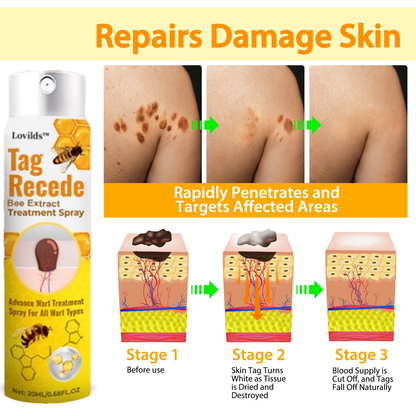 🐝Limited-Time Offer: 83% OFF🐝 LOVILDS™ TagRecede Bee Extract Treatment Spray💎
