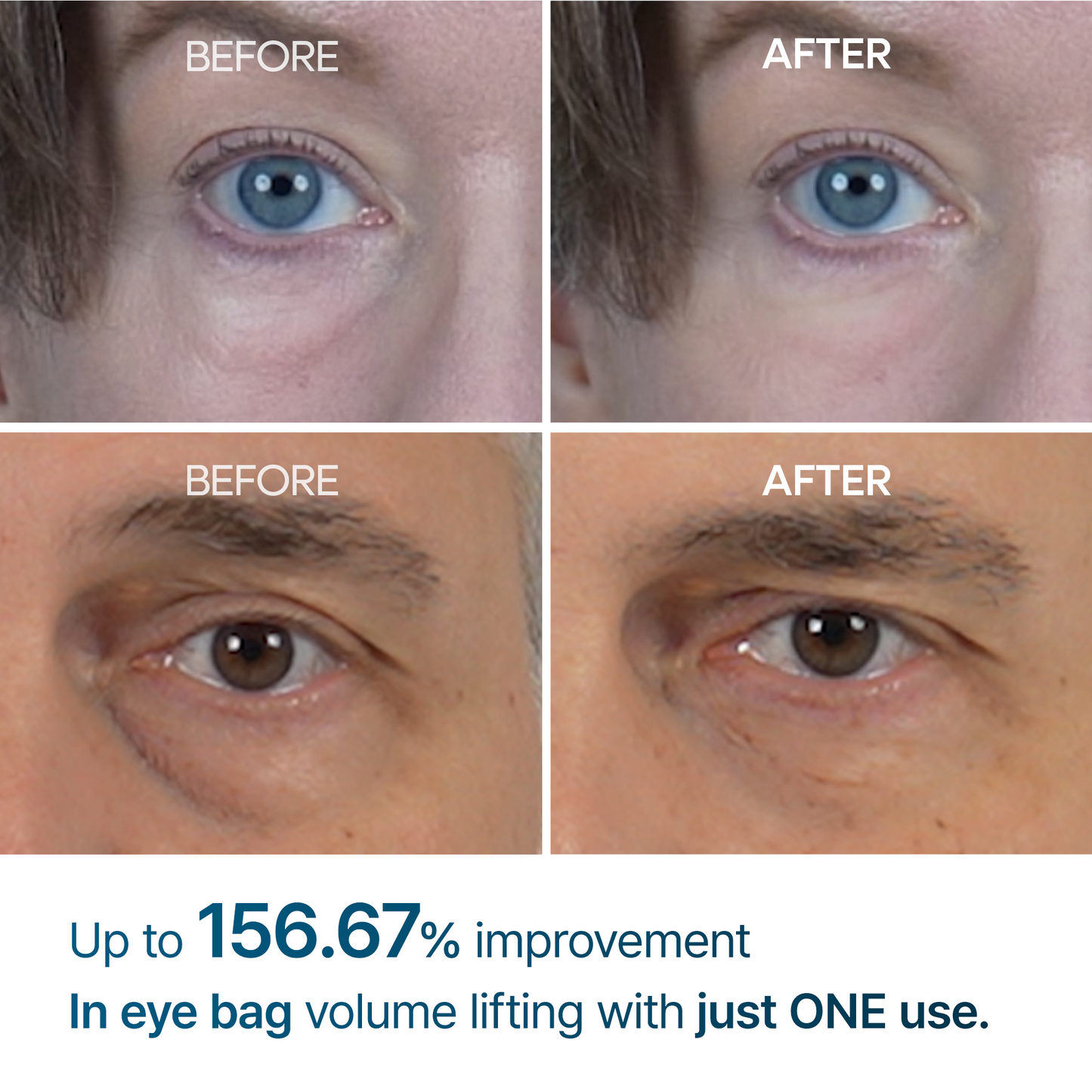 Eyephalt eyebag cream2