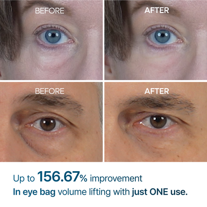 Eyephalt eyebag cream2