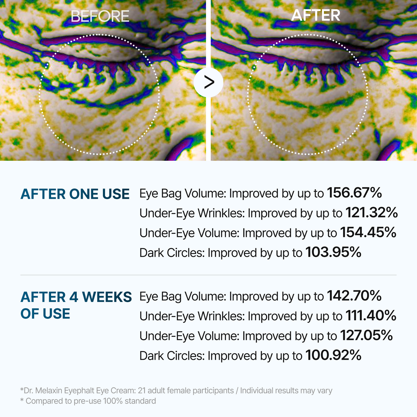 Eyephalt eyebag cream2