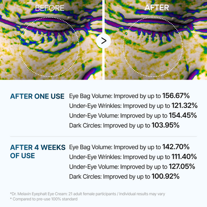 Eyephalt eyebag cream2